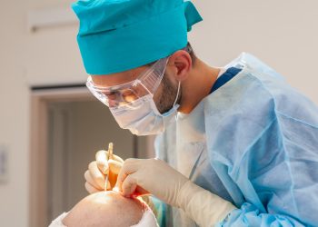 Baldness treatment. Hair transplant. Surgeons in the operating room carry out hair transplant surgery. Surgical technique that moves hair follicles from a part of the head.